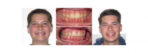 orthodontist near me