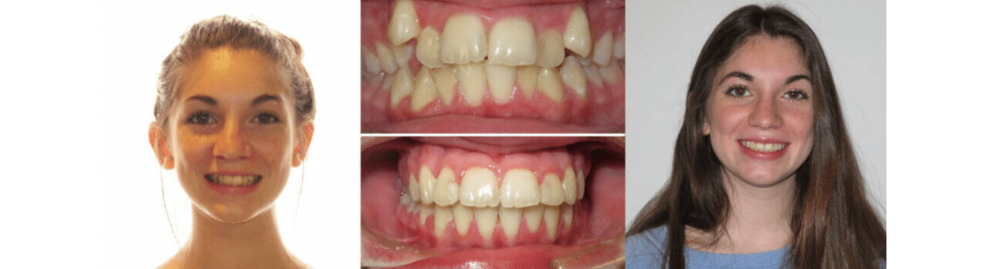 orthodontist-near-me-2